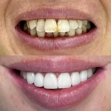 Slider image (3) Astra Dental Clinic